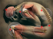 Nutrition for arthritis?